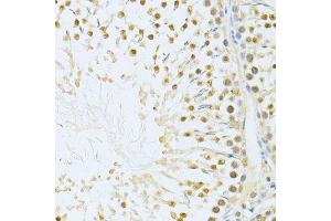 Immunohistochemistry (Paraffin-embedded Sections) (IHC (p)) image for anti-V-Akt Murine Thymoma Viral Oncogene Homolog 1 (AKT1) (C-Term) antibody (ABIN6136733)