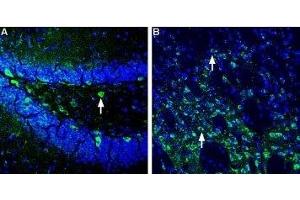 Expression of Homer1 in mouse hippocampus and striatum - Immunohistochemical staining of perfusion-fixed frozen mouse brain sections using Anti-Homer1 Antibody (ABIN7043273, ABIN7045168 and ABIN7045169), (1:400), followed by goat-anti-rabbit-AlexaFluor-488 secondary antibody. (HOMER1 抗体  (Intracellular))
