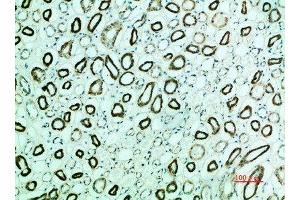 Immunohistochemical analysis of paraffin-embedded human-kidney, antibody was diluted at 1:200 (PTH1R 抗体  (AA 1268-1341))