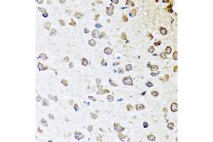 Immunohistochemistry of paraffin-embedded mouse brain using SERPINA10 antibody (ABIN5974273) at dilution of 1/100 (40x lens). (SERPINA10 抗体)