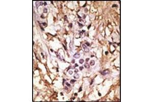 Immunohistochemistry (Paraffin-embedded Sections) (IHC (p)) image for anti-Microtubule-Associated Protein 1 Light Chain 3 beta (MAP1LC3B) (AA 88-118), (C-Term) antibody (ABIN1449627)