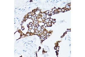 Immunohistochemistry (IHC) image for anti-Keratin 19 (KRT19) (AA 241-400) antibody (ABIN3020779)