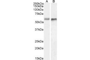 Western Blot using anti-BACE2 antibody 1/9 HeLa (A) and U251 (B) cell lysate samples (35 μg protein in RIPA buffer) were resolved on a 10 % SDS PAGE gel and blots probed with the chimeric mouse IgG1 version of 1/9 (ABIN7072331) at 1 μg/mL before detection using an anti-mouse secondary antibody. (Recombinant BACE2 抗体)
