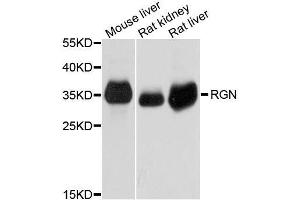 Western blot analysis of extracts of various cell lines, using RGN antibody. (Regucalcin 抗体  (AA 1-299))