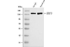 Western blot analysis of IRBP/RBP3 using anti-IRBP/RBP3 antibody (ABIN7601363).