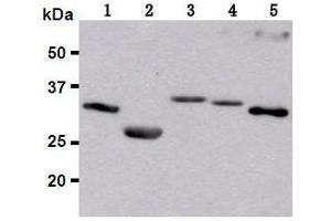 Western Blotting (WB) image for anti-Red Fluorescent Protein (RFP) antibody (ABIN1449291) (RFP 抗体)