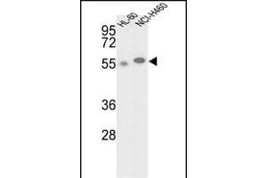 Western blot analysis of hGALK2-M1 (ABIN391115 and ABIN2841245) in HL-60, NCI- cell line lysates (35 μg/lane). (GALK2 抗体  (N-Term))