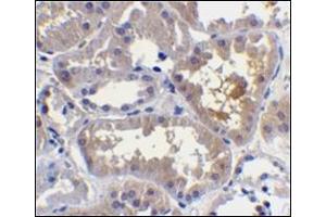 Immunohistochemistry (Paraffin-embedded Sections) (IHC (p)) image for anti-CASP2 and RIPK1 Domain Containing Adaptor with Death Domain (CRADD) (C-Term) antibody (ABIN500563)