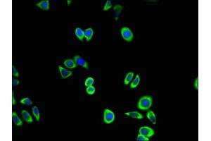 Immunofluorescence (IF) image for anti-Cyclin-Dependent Kinase 5 (CDK5) (AA 1-292) antibody (ABIN7148931)