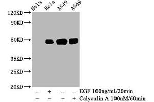 Western Blot  Positive WB detected in: Hela whole cell lysate, A549 whole cell lysate(treated with Calyculin A or EGF)  All lanes: Phospho-JUN antibody at 0. (Recombinant C-JUN 抗体  (pSer63))
