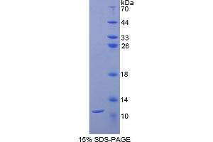SDS-PAGE analysis of Rat CD3d Protein. (CD3D 蛋白)