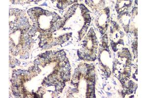 IHC analysis of FH using anti-FH antibody (ABIN7603168).