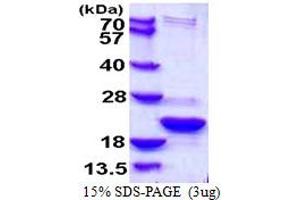 Thioredoxin-Like 4B (TXNL4B) (AA 1-149) protein (His tag)