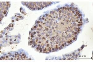 IHC analysis of MSY2/YBOX2/YBX2 using anti-MSY2/YBOX2/YBX2 antibody (ABIN7600636).