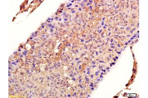 Immunohistochemistry (IHC) image for anti-Heat Shock Protein 90kDa alpha (Cytosolic), Class B Member 1 (HSP90AB1) (AA 601-732) antibody (ABIN672021)