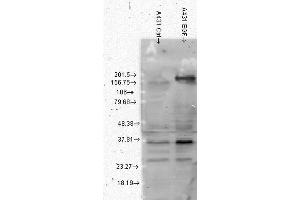 Western Blot analysis of Human A431 cell lysates showing detection of Phosphotyrosine protein using Mouse Anti-Phosphotyrosine Monoclonal Antibody, Clone G104 . (Phosphotyrosine 抗体  (PE))