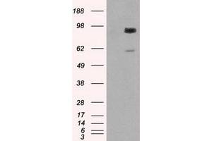 Western Blotting (WB) image for anti-Glucan (1,4-alpha-), Branching Enzyme 1 (GBE1) antibody (ABIN1498395) (GBE1 抗体)