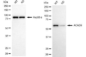 Western blotting analysis using ACAD9 antibody (ABIN7797495). (ACAD9 抗体)