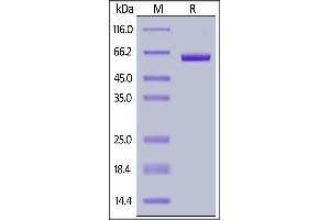 SDS-PAGE (SDS) image for Sialic Acid Binding Ig-Like Lectin 15 (SIGLEC15) (AA 20-263) (Active) protein (Fc Tag,AVI tag,Biotin) (ABIN6923188)