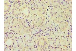 Immunohistochemistry of paraffin-embedded human pancreatic tissue using ABIN7143446 at dilution of 1:100 (ARF3 抗体  (AA 1-181))
