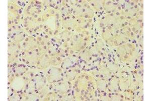 Immunohistochemistry of paraffin-embedded human pancreatic tissue using ABIN7143446 at dilution of 1:100 (ARF3 抗体  (AA 1-181))