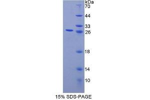 SDS-PAGE (SDS) image for Calcium Binding Protein P22 (CHP) (AA 2-195) protein (His tag) (ABIN6238957)