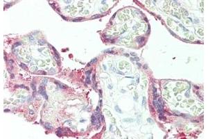 Immunohistochemistry of rabbit anti-Plasminogen Activator 2 antibody (ABIN349627). (SERPINB2 抗体  (Internal Region))