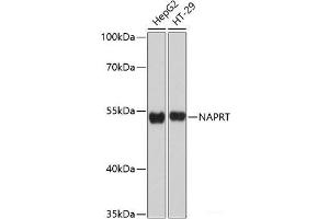 Western blot analysis of extracts of various cell lines using NAPRT Polyclonal Antibody at dilution of 1:3000. (NAPRT1 抗体)