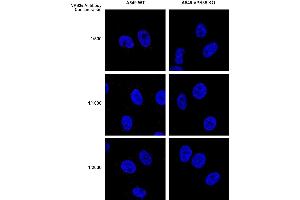 Immunocytochemistry (ICC) image for anti-Vacuolar Protein Sorting 35 (VPS35) antibody (PerCP) (ABIN6932953)