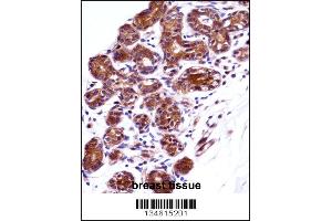 IMPDH1 Antibody immunohistochemistry analysis in formalin fixed and paraffin embedded human breast tissue followed by peroxidase conjugation of the secondary antibody and DAB staining.