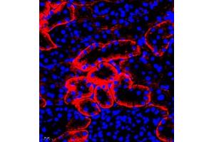 Immunofluorescence of paraffin embedded rat kidney using SLC7A8 (ABIN7074503) at dilution of 1:300 (400x lens) (LAT2 抗体)