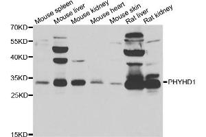 Western blot analysis of extracts of various cell lines, using PHYHD1 antibody. (PHYHD1 抗体)