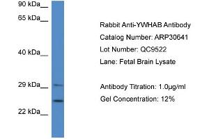WB Suggested Anti-YWHAB Antibody   Titration: 1. (YWHAB 抗体  (Middle Region))
