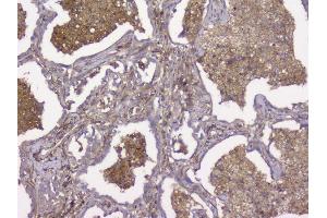IHC analysis of Beta 2 Microglobulin using anti-Beta 2 Microglobulin antibody (ABIN6719452). (beta-2 Microglobulin 抗体  (AA 22-119))