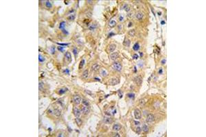 Image no. 1 for anti-Mitochondrial Intermediate Peptidase (MIPEP) (Center) antibody (ABIN356963) (MIPEP 抗体  (Center))