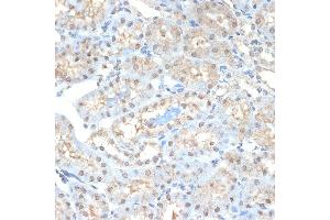 Immunohistochemistry of paraffin-embedded mouse kidney using PSM Rabbit mAb (ABIN7269597) at dilution of 1:100 (40x lens).