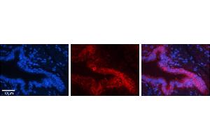 Immunohistochemistry (IHC) image for anti-Proteasome Subunit alpha Type 1 (PSMA1) (C-Term) antibody (ABIN2778810)