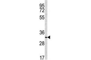 Western blot analysis of NQO1 antibody and NCI-H460 lysate (NQO1 抗体  (AA 118-144))