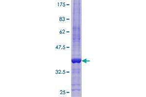 Reprimo Protein (RPRM) (AA 1-109) (GST tag)