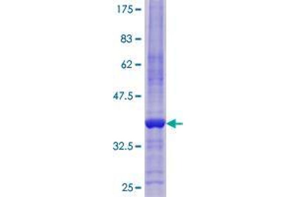 Reprimo Protein (RPRM) (AA 1-109) (GST tag)