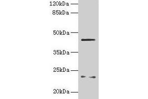 Western blot All lanes: FIBP antibody at 6 μg/mL + MCF-7 whole cell lysate Secondary Goat polyclonal to rabbit IgG at 1/10000 dilution Predicted band size: 42 kDa Observed band size: 42 kDa (FIBP 抗体  (AA 2-357))