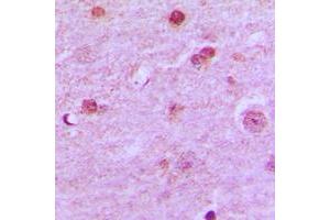 Immunohistochemical analysis of N4BP1 staining in human brain formalin fixed paraffin embedded tissue section. (N4BP1 抗体  (Center))