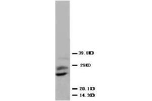Western blot analysis of human placenta tissue lysis using PLGF antibody (PLGF 抗体  (N-Term))