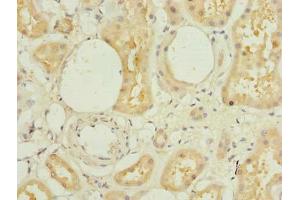 Immunohistochemistry of paraffin-embedded human kidney tissue using ABIN7172386 at dilution of 1:100 (L3HYPDH 抗体  (AA 13-312))