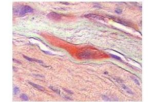 CSF1  CSF1 in human placenta was detected using HRP/AEC red color stain. (M-CSF/CSF1 抗体  (Middle Region))