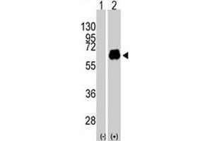 Western blot analysis of MYC (arrow) using MYC polyclonal antibody . (c-MYC 抗体  (Thr58))