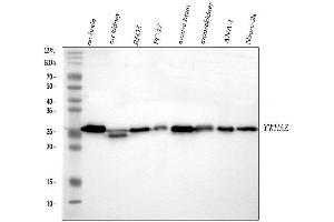 Western blot analysis of 14-3-3 zeta/delta using anti-14-3-3 zeta/delta antibody (ABIN5693157). (14-3-3 zeta 抗体)