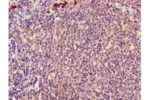 Immunohistochemistry of paraffin-embedded human lymph node tissue using ABIN7145576 at dilution of 1:100 (ATIC 抗体  (AA 301-592))