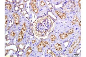 Formalin-fixed and paraffin embedded rat kidney tissue labeled with Anti-ET-1 Polyclonal Antibody, Unconjugated(bsm-0954M) 1:200 at followed by conjugation to the secondary antibody and DAB staining (Endothelin 1 抗体)