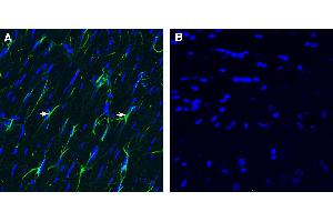 Expression of CD9 in rat fornix. (CD9 抗体  (Extracellular))